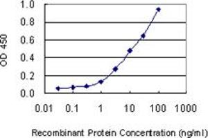 Detection limit for recombinant GST tagged KRT1 is 0.