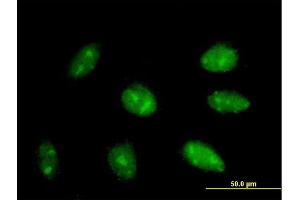 Immunofluorescence of purified MaxPab antibody to EXOSC3 on HepG2 cell. (EXOSC3 anticorps  (AA 1-275))