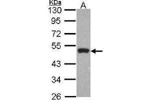 WB Image Sample (30 ug of whole cell lysate) A: Hela 10% SDS PAGE Peripherin antibody antibody diluted at 1:1000 (Peripherin anticorps)