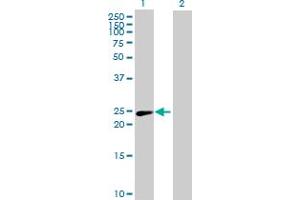 Western Blot analysis of PSMD10 expression in transfected 293T cell line by PSMD10 MaxPab polyclonal antibody.