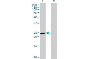 Western Blot analysis of PSMD10 expression in transfected 293T cell line by PSMD10 MaxPab polyclonal antibody. (PSMD10 anticorps  (AA 1-226))