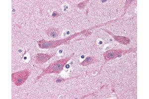 Anti-GABRB1 antibody IHC of human brain, cortex.