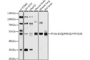 Western blot analysis of extracts of various cell lines, using PP2A-B55β/PR55β/PP2A-B55β/PR55β/PPP2R2B antibody (ABIN6132513, ABIN6146087, ABIN6146088 and ABIN6214771) at 1:1000 dilution. (PPP2R2B anticorps  (AA 160-260))