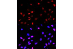 Immunofluorescence analysis of NIH-3T3 cells using TCF4 Rabbit pAb (ABIN3021529, ABIN3021530, ABIN3021531, ABIN1513591 and ABIN6215200) at dilution of 100 (40x lens).