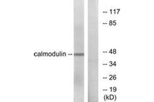 Western blot analysis of extracts from NIH-3T3 cells, using Calmodulin (Ab-79/81) Antibody. (Calmodulin 1 anticorps  (AA 46-95))