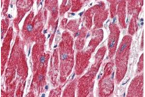 Anti-MMP14 antibody IHC of human heart. (MMP14 anticorps  (AA 160-173))