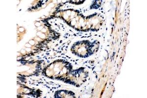 IHC-P: PLK2 antibody testing of rat intestine tissue (PLK2 anticorps  (C-Term))