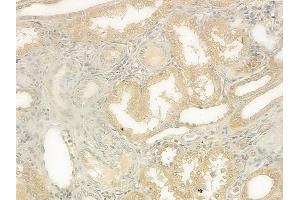 ABIN6263174 and ABIN6273136 at 1/100 staining human normal kidney tissue by IHC-P. (DIAPH1 anticorps  (N-Term))