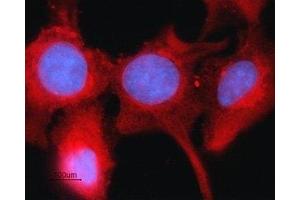 Expression of Connexin-43 in rat intestinal epithelial IEC-6 cells - Immunocytochemical staining of fixed and permeabilized rat intestinal epithelial IEC-6 cells.