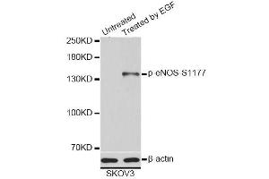 Western blot analysis of extracts of SKOV3 cells, using Phospho-eNOS-S1177 antibody (ABIN5995597). (ENOS anticorps  (pSer1177))
