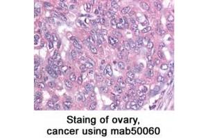 Image no. 2 for anti-Baculoviral IAP Repeat-Containing 5 (BIRC5) antibody (ABIN363214)