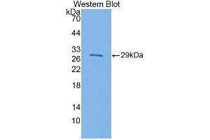 Western blot analysis of the recombinant protein. (SIRPB1 anticorps  (AA 127-356))