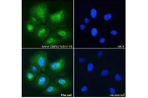 ABIN184677 Immunofluorescence analysis of paraformaldehyde fixed U2OS cells, permeabilized with 0.