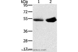 Western blot analysis of Human placenta and plasma tissue, using SLC13A3 Polyclonal Antibody at dilution of 1:200 (SLC13A3 anticorps)