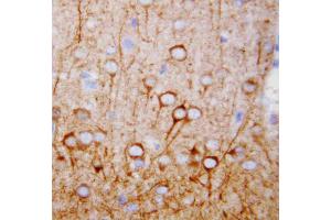 Anti-CaMKK antibody, IHC(P): Rat Brain Tissue (CAMKK1 anticorps  (N-Term))