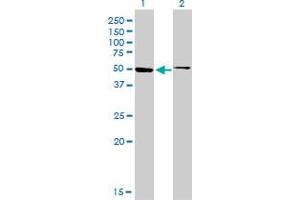 Western Blot analysis of HNF4A expression in transfected 293T cell line by HNF4A monoclonal antibody (M04), clone 4E2.