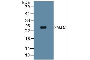 Western blot analysis of Human Blood Cells. (SOD3 anticorps  (AA 19-240))