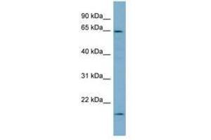 anti-Plastin 3 (PLS3) (AA 503-552) antibody