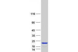 Validation with Western Blot