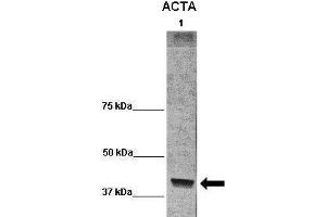 WB Suggested Anti-ACTA1 Antibody  Positive Control: Lane 1:541 µg term baboon muscle homogenate Primary Antibody Dilution: 1:0666Secondary Antibody: Anti-rabbit-HRP Secondry  Antibody Dilution: 1:0200Submitted by: Cynthia Blanco, University of Texas Health Science Center (Actin anticorps  (C-Term))