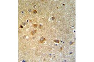 Immunohistochemistry analysis in formalin fixed and paraffin embedded brain tissue reacted with GTSE1 Antibody (C-term) followed which was peroxidase conjugated to the secondary antibody and followed by DAB staining.