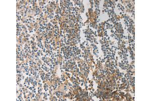 Immunohistochemistry of Human tonsil using PRMT5 Polyclonal Antibody at dilution of 1:20 (PRMT5 anticorps)