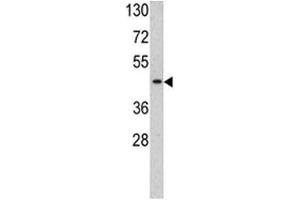 Western blot analysis of TBP antibody and HL-60 lysate. (TBP anticorps  (AA 301-330))