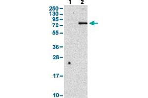 Western Blot analysis with CD248 polyclonal antibody . (CD248 anticorps  (AA 375-457))