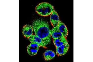 Confocal immunofluorescent analysis of SOCS4 Antibody (Center) (ABIN655792 and ABIN2845222) with  cell followed by Alexa Fluor 488-conjugated goat anti-rabbit lgG (green).