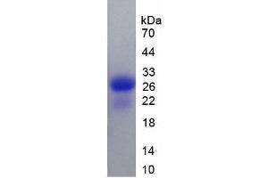 SDS-PAGE analysis of Rat Calbindin Protein. (CALB1 Protéine)