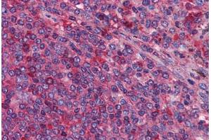 Human Spleen: Formalin-Fixed, Paraffin-Embedded (FFPE) (MIA3 anticorps  (AA 1-120))