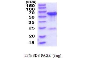 SDS-PAGE (SDS) image for TBC1 Domain Family, Member 22B (TBC1D22B) (AA 1-505) protein (His tag) (ABIN6387596)