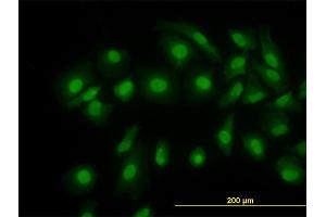 Immunofluorescence of monoclonal antibody to CFL1 on HeLa cell.