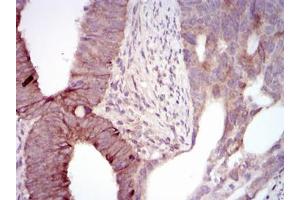 Immunohistochemistry (IHC) image for anti-Maternal Embryonic Leucine Zipper Kinase (MELK) antibody (ABIN1108210) (MELK anticorps)