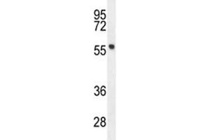 FEZF1 antibody western blot analysis in mouse stomach tissue lysate.