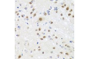 Immunohistochemistry of paraffin-embedded rat brain using CETN3 antibody (ABIN5974786) at dilution of 1/100 (40x lens).