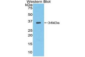 Western Blotting (WB) image for anti-3-phosphoinositide Dependent Protein Kinase-1 (PDPK1) (AA 83-338) antibody (ABIN3205317) (PDPK1 anticorps  (AA 83-338))