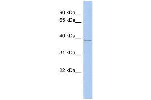 WB Suggested Anti-PNMA1 Antibody Titration:  0. (PNMA1 anticorps  (Middle Region))