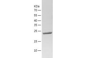 Western Blotting (WB) image for WNT1 Inducible Signaling Pathway Protein 2 (WISP2) (AA 24-250) protein (His-IF2DI Tag) (ABIN7125737)