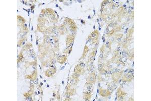 Immunohistochemistry of paraffin-embedded Human stomach using FANCA Polyclonal Antibody at dilution of 1:100 (40x lens).