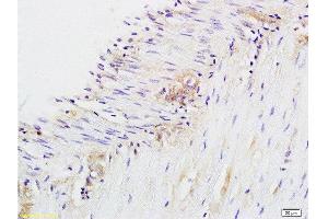 Formalin-fixed and paraffin embedded rat colitis labeled with Anti-CD28 Polyclonal Antibody, Unconjugated  at 1:200 followed by conjugation to the secondary antibody and DAB staining. (CD28 anticorps  (AA 1-120))