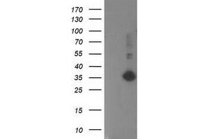 Western Blotting (WB) image for anti-Sirtuin 5 (SIRT5) antibody (ABIN1500935) (SIRT5 anticorps)