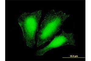 Immunofluorescence of monoclonal antibody to ATOX1 on HeLa cell. (ATOX1 anticorps  (AA 1-68))