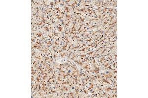 anti-Hexosaminidase A (HEXA) (AA 142-170), (N-Term) antibody