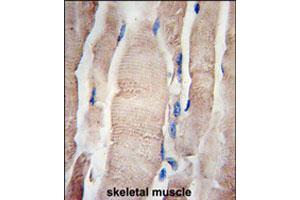 Formalin-fixed and paraffin-embedded human skeletal muscle tissue reacted with PHPT1 polyclonal antibody  , which was peroxidase-conjugated to the secondary antibody, followed by DAB staining. (PHPT1 anticorps  (C-Term))