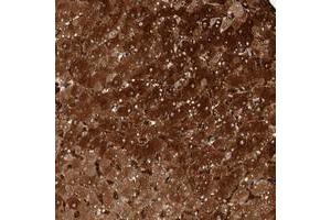 Immunohistochemical staining of human liver with ZNF862 polyclonal antibody  shows strong cytoplasmic positivity in hepatocytes. (ZNF862 anticorps)