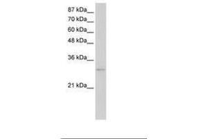Image no. 3 for anti-Exosome Component 6 (EXOSC6) (N-Term) antibody (ABIN202141)