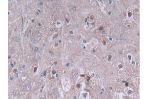 DAB staining on IHC-P; Samples: Rat Spinal cord Tissue (PF4 anticorps  (AA 30-105))