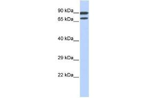 ZNF583 antibody used at 0. (ZNF583 anticorps  (N-Term))