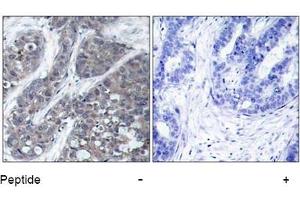 Image no. 1 for anti-PTK2B Protein tyrosine Kinase 2 beta (PTK2B) (Tyr402) antibody (ABIN197440)